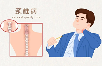 警惕！骨與關(guān)節(jié)的“健康危機(jī)”，你中招了嗎？